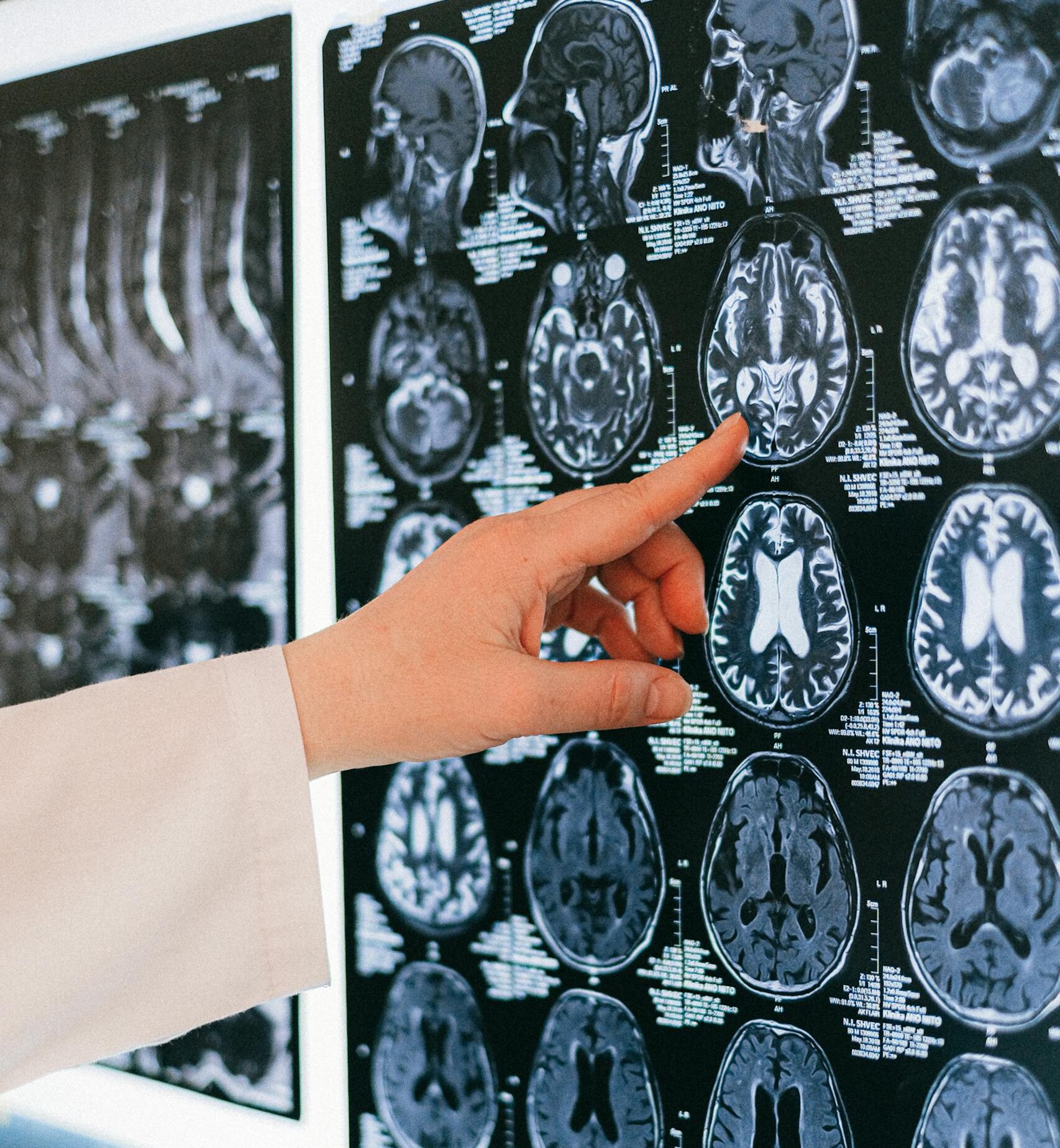 Finger Pointing to a Brain Scan